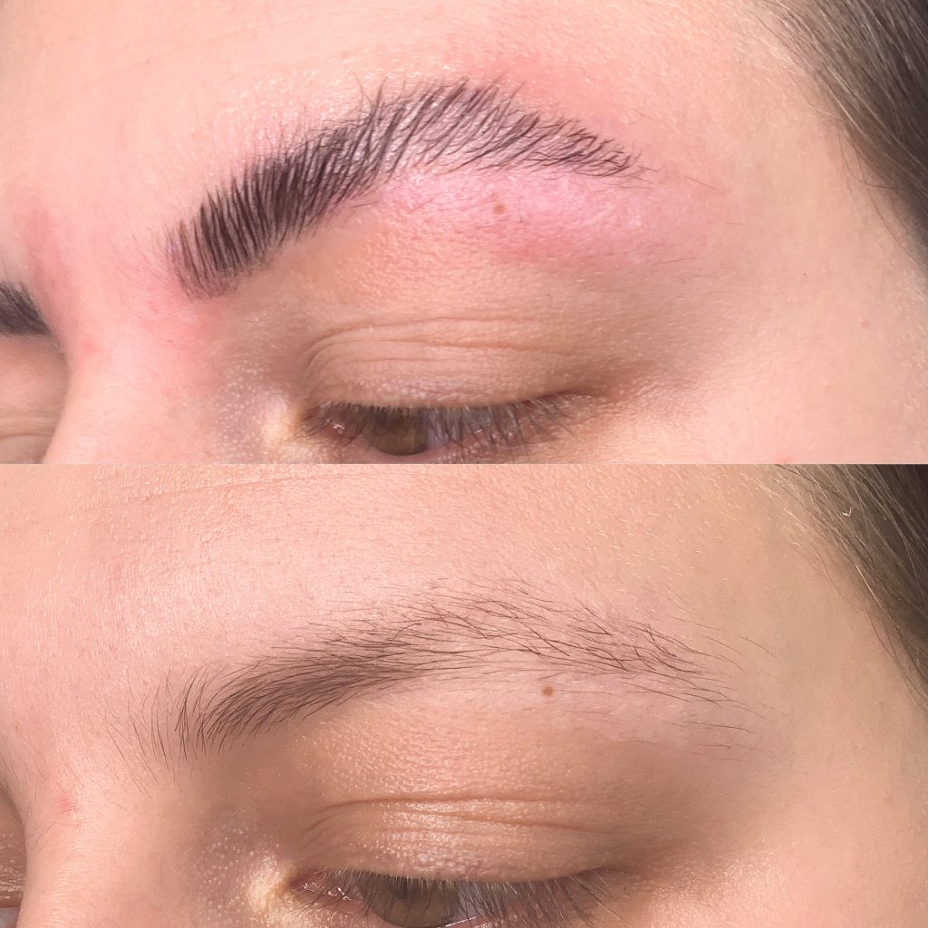 browlifting niederösterreich persenbeug birgit brezina